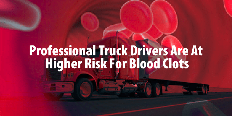 Professional Drivers & DVT: What You Need To Know in 2017