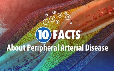 10 FACTS About Peripheral Arterial Disease – Part 2