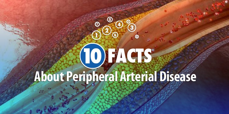 10 FACTS About Peripheral Arterial Disease
