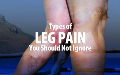 Types of Leg Pain You Should Not Ignore!